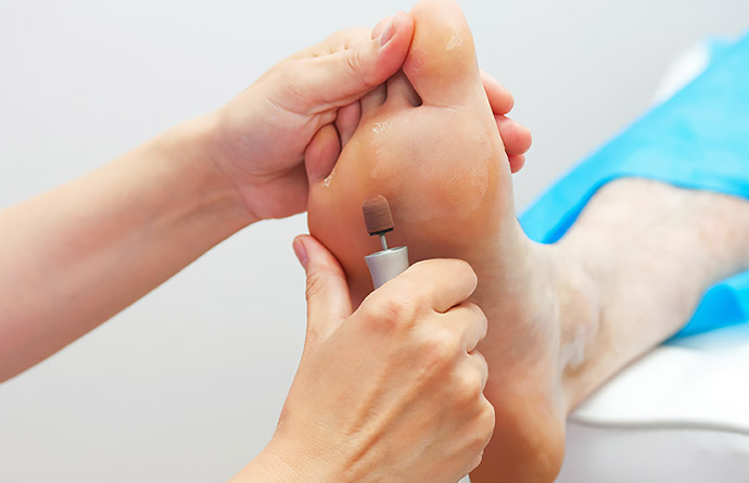 Nasır nasıl geçer bitkisel